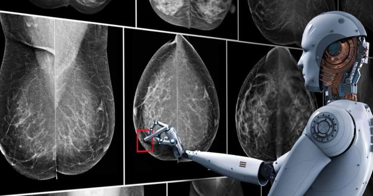 AI-Powered Mammograms